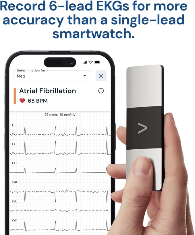 KardiaMobile 6-Lead Personal EKG Monitor – Six Views of The Heart – Detects AFib and Irregular Arrhythmias – Instant Results in 30 Seconds – Works with Most Smartphones