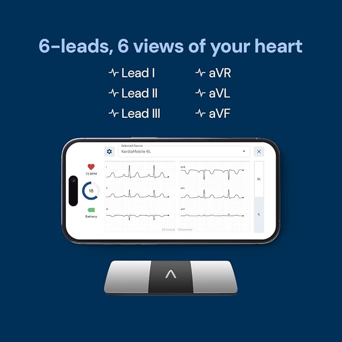 KardiaMobile 6-Lead Personal EKG Monitor – Six Views of The Heart – Detects AFib and Irregular Arrhythmias – Instant Results in 30 Seconds – Works with Most Smartphones