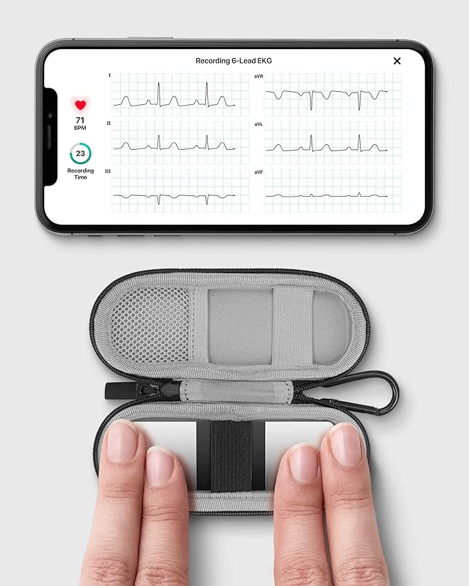 Heart Monitor Case for AliveCor KardiaMobile 6L and Kardia Mobile EKG Monitor, Travel case for AliveCor Kardia Mobile 1-Lead Personal EKG Monitor/KardiaMobile 6-Lead Personal EKG Monitor